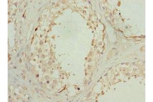 Immunohistochemistry of paraffin-embedded human testis tissue using ABIN7162292 at dilution of 1:100 (OAZ1 Antikörper  (AA 1-68))
