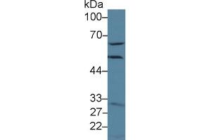 Detection of GCLM in Human Hela cell lysate using Polyclonal Antibody to Glutamate Cysteine Ligase, Modifier Subunit (GCLM) (GCLM Antikörper  (AA 40-251))