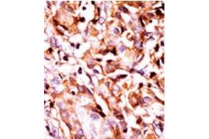 Image no. 1 for anti-BCL2-Associated Agonist of Cell Death (BAD) (pSer99) antibody (ABIN358087) (BAD Antikörper  (pSer99))