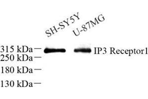 Western blot analysis of IP3R1 (ABIN7074293) at dilution of 1: 500 (IP3 Receptor Antikörper)