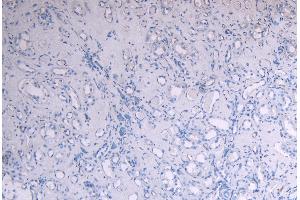 Immunohistochemistry (IHC) image for anti-Suppressor of Cytokine Signaling 1 (SOCS1) (C-Term) antibody (ABIN184575)
