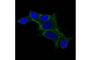 Image no. 1 for anti-Ornithine Decarboxylase 1 (ODC1) antibody (ABIN6188965) (ODC1 Antikörper)