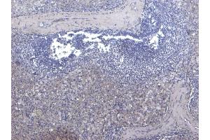 (ABIN185707) Negative Control showing staining of paraffin embedded Human Spleen, with no primary antibody.