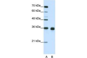 Western Blotting (WB) image for anti-Wingless-Type MMTV Integration Site Family, Member 2B (WNT2B) antibody (ABIN2462377) (WNT2B Antikörper)