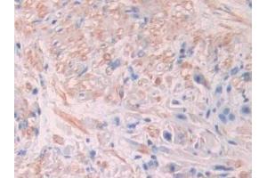 Detection of ACVR2A in Human Prostate Tissue using Polyclonal Antibody to Activin A Receptor Type II A (ACVR2A)