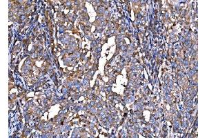 IHC analysis of RPL32 using anti-RPL32 antibody (ABIN7601826).