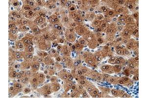 Image no. 14 for anti-EPM2A (Laforin) Interacting Protein 1 (EPM2AIP1) antibody (ABIN1498047) (EPM2AIP1 Antikörper)