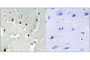 Immunohistochemistry analysis of paraffin-embedded human brain tissue, using TREF1 Antibody. (TRERF1 Antikörper  (AA 1071-1120))