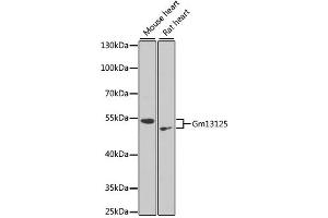 Western blot analysis of extracts of various cell lines, using Gm13125 antibody. (Pramel15 Antikörper)