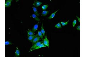 Immunofluorescent analysis of Hela cells using ABIN7175541 at dilution of 1:100 and Alexa Fluor 488-congugated AffiniPure Goat Anti-Rabbit IgG(H+L) (PROC Antikörper  (AA 288-409))