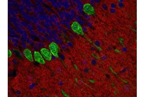 Immunohistochemistry (Paraffin-embedded Sections) (IHC (p)) image for anti-Glycoprotein M6A (GPM6A) (AA 261-270) antibody (ABIN1742485)