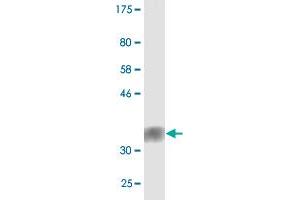 Western Blot detection against Immunogen (36. (TNRC6C Antikörper  (AA 1-100))