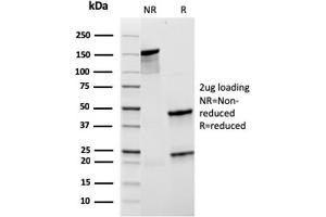 SDS-PAGE Analysis Purified CD21 Recombinant Mouse Monoclonal Antibody (rCR2/1952). (Rekombinanter CD21 Antikörper  (AA 44-196))