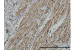 Image no. 1 for anti-Pyruvate Dehydrogenase beta (PDHB) (AA 250-360) antibody (ABIN598861) (PDHB Antikörper  (AA 250-360))