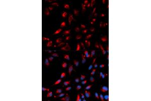 Immunofluorescence (IF) image for anti-Carboxypeptidase E (CPE) antibody (ABIN1876646) (CPE Antikörper)