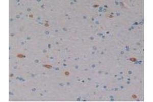 DAB staining on IHC-P; Samples: Human Brain Tissue. (EPO Antikörper  (AA 28-193))