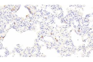 Immunohistochemistry (IHC) image for anti-Tryptase alpha/beta 1 (TPSAB1) (AA 151-275) antibody (ABIN7433102)