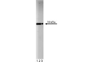Western Blotting (WB) image for anti-Cyclin-Dependent Kinase 2 (CDK2) (AA 109-298) antibody (ABIN967777)