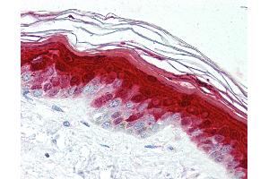 Anti-S100A7 antibody IHC of human skin. (S100A7 Antikörper)