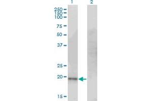 Western Blot analysis of CDO1 expression in transfected 293T cell line by CDO1 monoclonal antibody (M09), clone 4B4.