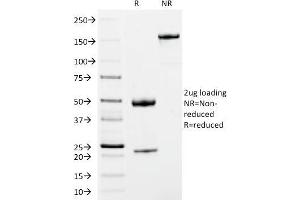 SDS-PAGE Analysis Purified IgM Mouse Monoclonal Antibody (IM373). (IGHM Antikörper  (CF®488A))
