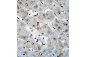 Immunohistochemistry analysis in formalin fixed and paraffin embedded human liver tissue reacted with H2AFZ Antibody (C-term) followed by peroxidase conjugation of the secondary antibody and DAB staining. (H2AFZ Antikörper  (C-Term))