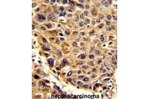 Immunohistochemistry (IHC) image for anti-Signal Peptidase Complex Subunit 3 Homolog (SPCS3) antibody (ABIN3002742) (SPCS3 Antikörper)