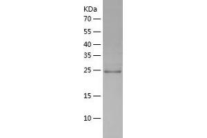 Western Blotting (WB) image for Deoxythymidylate Kinase (Thymidylate Kinase) (DTYMK) (AA 1-212) protein (His tag) (ABIN7122638) (DTYMK Protein (AA 1-212) (His tag))