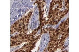 ABIN6268682 at 1/100 staining human breast tissues sections by IHC-P. (BAG1 Antikörper  (N-Term))