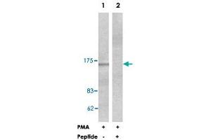 Western blot analysis of extracts from HeLa cells treated with PMA (125 ng/ml, 30 min), using PLCB3 polyclonal antibody . (PLCB3 Antikörper  (Ser1105))