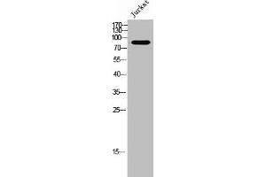 Western Blot analysis of Jurkat cells using Relaxin Receptor 2 Polyclonal Antibody (RXFP2 Antikörper  (Internal Region))