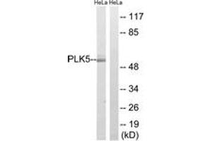 Western blot analysis of extracts from HeLa cells, using PLK5 Antibody. (PLK5 Antikörper  (AA 131-180))