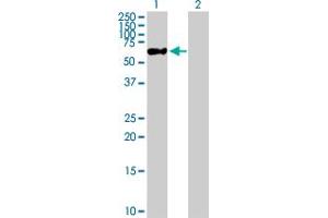 Western Blot analysis of ZNF671 expression in transfected 293T cell line by ZNF671 MaxPab polyclonal antibody. (ZNF671 Antikörper  (AA 1-556))