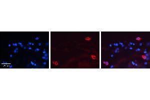 MAP2K2 antibody - C-terminal region          Formalin Fixed Paraffin Embedded Tissue:  Human Lung Tissue    Observed Staining:  Cytoplasm of pneumocytes   Primary Antibody Concentration:  1:600    Secondary Antibody:  Donkey anti-Rabbit-Cy3    Secondary Antibody Concentration:  1:200    Magnification:  20X    Exposure Time:  0. (MEK2 Antikörper  (C-Term))