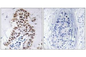 Immunohistochemistry (IHC) image for anti-Death-Associated Protein Kinase 3 (DAPK3) (Thr265) antibody (ABIN1848018)
