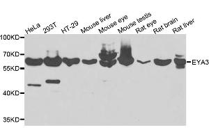Western blot analysis of extracts of various cell lines, using EYA3 antibody. (EYA3 Antikörper)