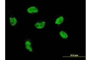 Immunofluorescence of monoclonal antibody to HOXA5 on HeLa cell. (HOXA5 Antikörper  (AA 171-270))