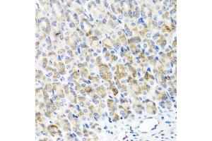 Immunohistochemistry of paraffin-embedded mouse stomach using RAD51C antibody (ABIN5974185) at dilution of 1/100 (40x lens). (RAD51C Antikörper)