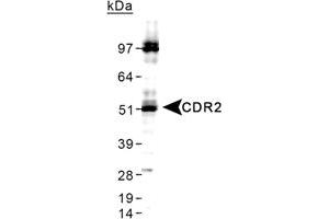 Western blot analysis of CDR2 in HeLa whole cell lysate using CDR2 polyclonal antibody . (CDR2 Antikörper  (C-Term))