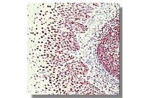 Image no. 1 for anti-X-Ray Repair Complementing Defective Repair in Chinese Hamster Cells 6 (XRCC6) antibody (ABIN187448) (XRCC6 Antikörper)