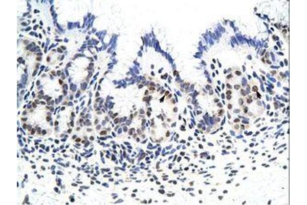 Zinc Finger Protein 296 (ZNF296) (C-Term) Antikörper