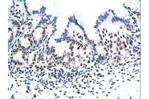 Image no. 2 for anti-Zinc Finger Protein 296 (ZNF296) (C-Term) antibody (ABIN6736191) (Zinc Finger Protein 296 (ZNF296) (C-Term) Antikörper)