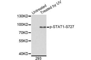 Western blot analysis of extracts from 293 cells, using Phospho-STAT1-S727 antibody (ABIN2988310). (STAT1 Antikörper  (pSer727))
