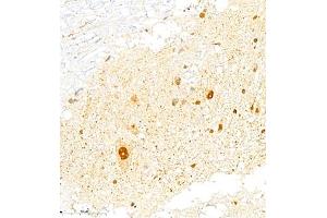 Immunohistochemistry of paraffin embedded rat spinal cord using FGF11 (ABIN7073941) at dilution of 1:2200 (400x lens) (FGF11 Antikörper)