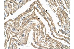 CCBP2 antibody was used for immunohistochemistry at a concentration of 4-8 ug/ml to stain Skeletal muscle cells (arrows) in Human Muscle.