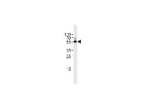 Western Blotting (WB) image for anti-Transforming Growth Factor, beta 2 (TGFB2) (AA 277-306), (C-Term) antibody (ABIN5536427)