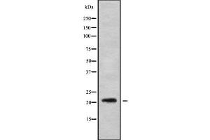 Western blot analysis of MED22 using NIH-3T3 whole cell lysates (MED22 Antikörper  (Internal Region))