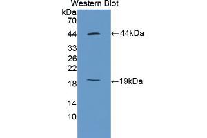 Western blot analysis of the recombinant protein. (Ki-67 Antikörper  (AA 2386-2674))