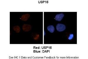 Sample Type :  Human brain stem cells (NT2)   Primary Antibody Dilution :   1:500  Secondary Antibody :  Goat anti-rabbit Alexa Fluor 594  Secondary Antibody Dilution :   1:1000  Color/Signal Descriptions :  Red: USBlue: DAPI  Gene Name :  US Submitted by :  Dr. (USP16 Antikörper  (N-Term))