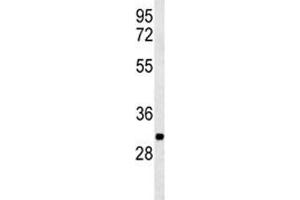 Western blot analysis of PGP antibody and K562 lysate (PGP Antikörper  (AA 33-62))